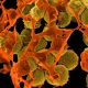 Staphylococcus aureus resistente a la meticilina o SARM